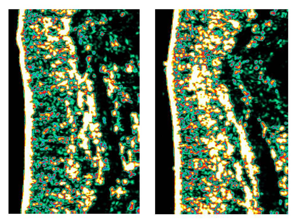 Fotografie “prima” e “dopo” delle cellule epiteliali dopo 3 mesi di vitamina C: maggiore spessore dei globuli bianchi