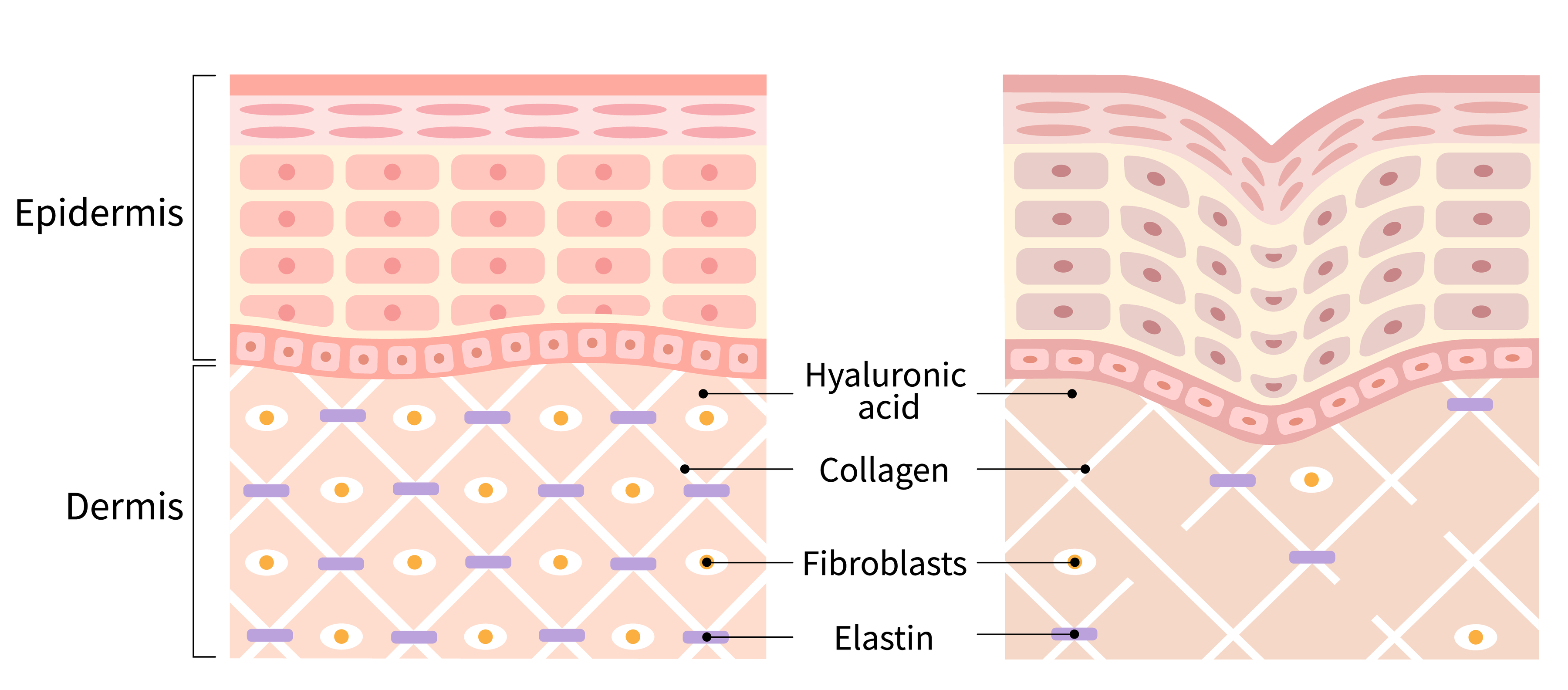 Collagen and Elastin Network in our skin